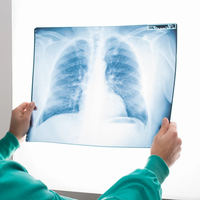 Lung Centre